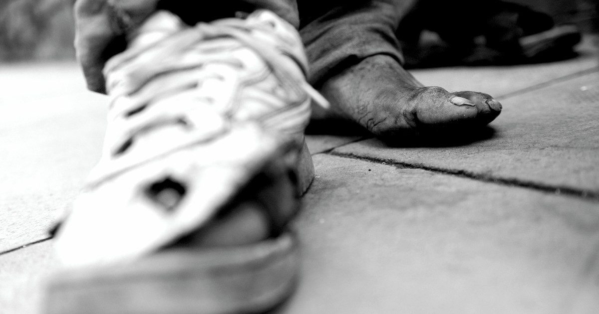 scarpe rotte
